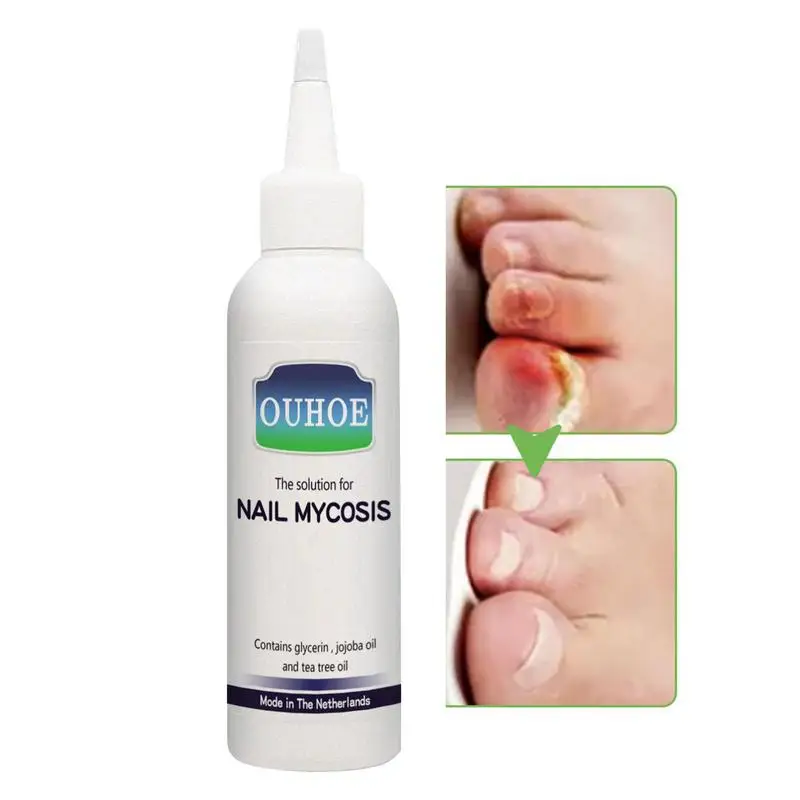 

75ml Cuticle Oil for Nails Professional & Intensive Nail Repair for Damaged Nails Cuticle Oil for Soft Peeling Nails Painless