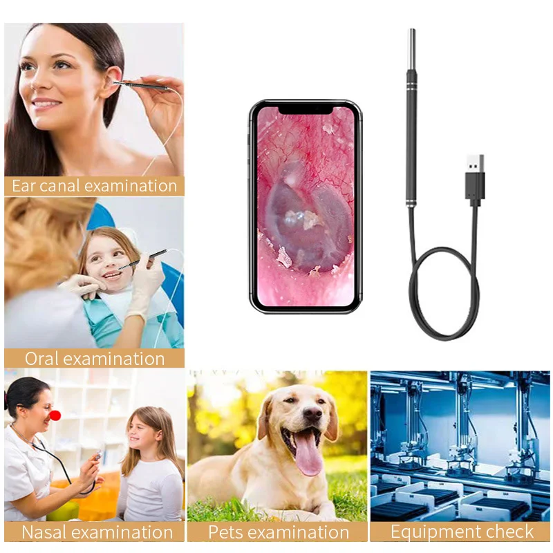 Nettoyeur d'oreille intelligent, endoscope cuillère 5.5mm, caméra étanche, cérumen, inspection buccale visuelle, prise en charge Android PC, outil de livres d'oreille