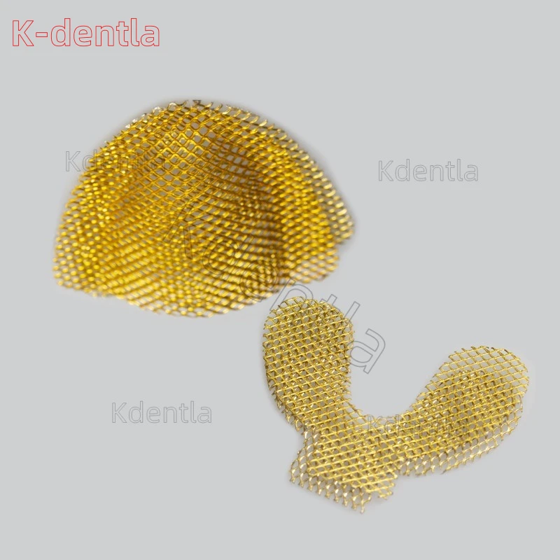 200Pcs Upper Lower Dental Lab Gold Denture Materials Golden Metal Palatal Reinforcement Mesh For Acrylic Partial Denture