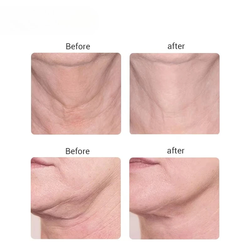 313 Ms.W Home Used Microcurrent Machine For Sale Neck Winkle Remover Weight Loss Body Slimming Beauty Face Neck Lifting Massager