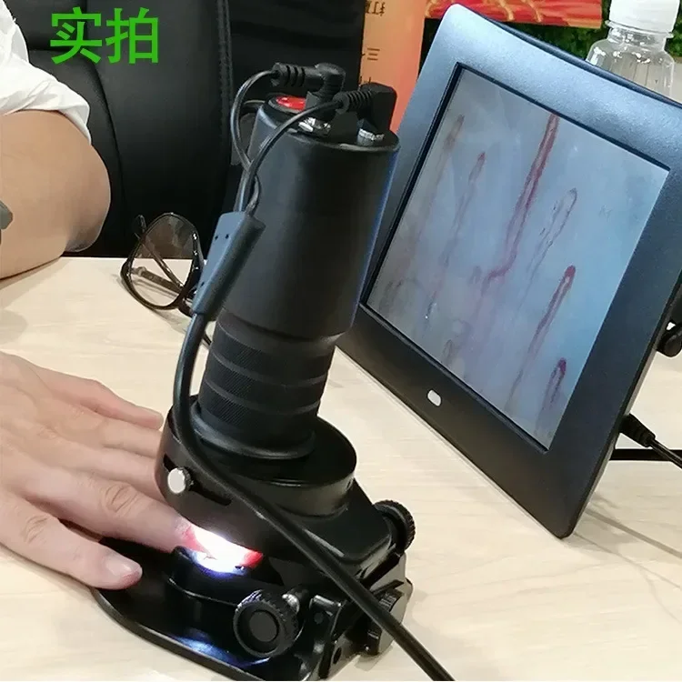 

2026 Hot SalesImported Chimao DMX980-1 Bl,ood Microcirculation Tester
