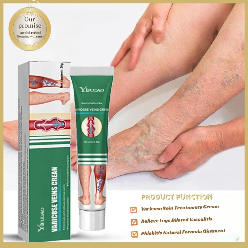 

Varicose Vein Treatments Cream Effective Relieve Legs Dilated Vasculitis Phlebitis Natural Formula Ointment For Varicose Veins