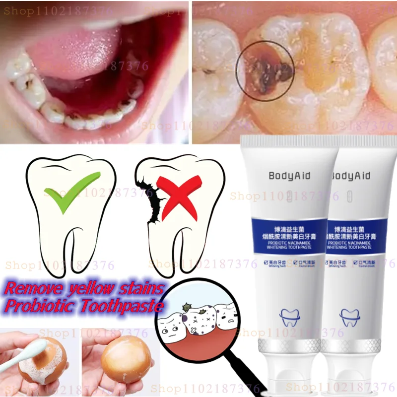 Probiotic Toothpaste Quickly Improves Tooth Decay, Relieves Gum Swelling and Pain, Removes Tooth Stains and Bad Breath