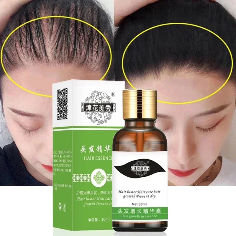 

Hair Care Growth Essential Oils Essence Original Authentic 100% Hair Loss Liquid Health Care Beauty Dense Nourish Hair