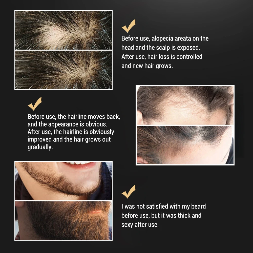 Beard Oil For Men Beard Growth Serum Beard Oil Leave-in Conditioner Restore Natural Moisture And Soften Your Beard To Prevent