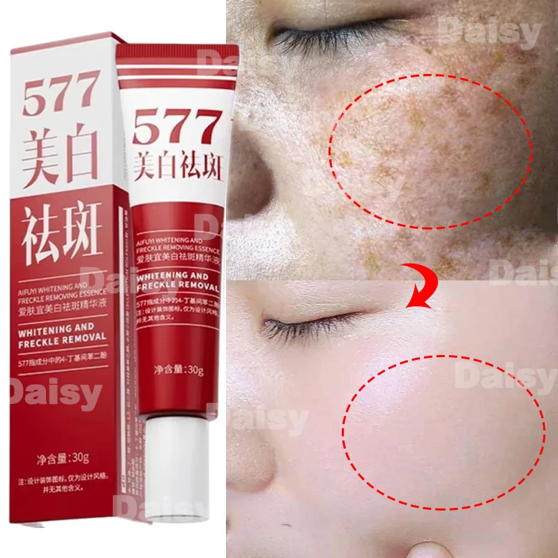 

Powerful Whitening Freckles Face Cream Removal Melasma Dark Spot Corrector Lighten Melanin Pigmentation Brightening Skin Care