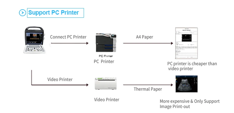 Yonker YK-UP8 Portable 64 Channels Ultrasound Machine Double Probe Interface Color Doppler Ultrasonic Ultrasound Machine