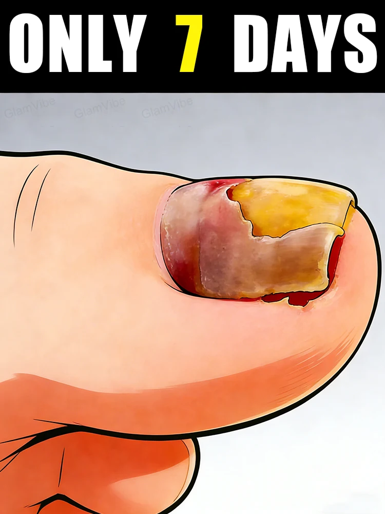 

Пожалуйста, чтобы желтая тусклость и шероховатость, вырастить гладкие блестящие ногти