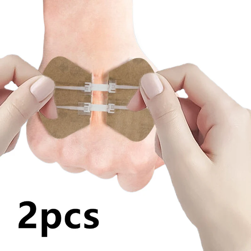 2 pezzi cerniera cravatta chiusura della ferita cerotto cerniera cerotto ferita sutura veloce cerotti emostatici portatili all'aperto strumento di primo soccorso