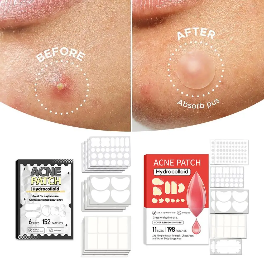 Patch maître de boutons fermés, 10/20/152/198 pièces, maquillage Invisible, masque d'absorption de la peau, respirant, soins pour sélections colloïdales Beau L2Q6
