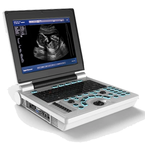 

Cheapest and affordable Full Digital Black and White Notebook/Laptop 12 inches Veterinary Ultrasound Scanner factory price