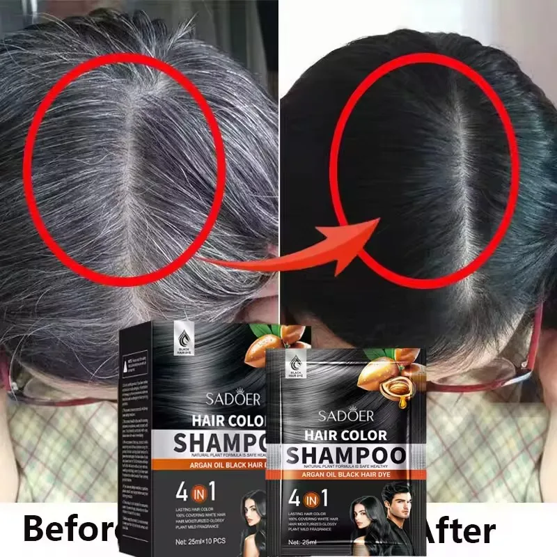 

Gray White Hair Treatment Shampoo White To Black Anti Gray Hair Beard Dye Anti Loss Repair Nourish Hair Care Products Men Women