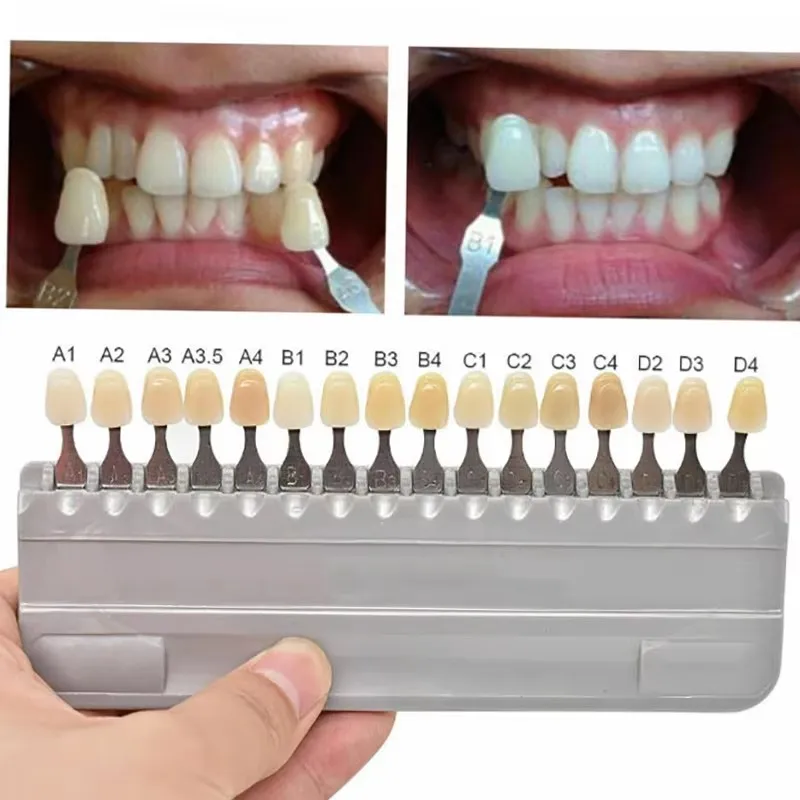 16 Colors Dental Bleaching Shade Guide Vita Teeth Whitening Porcelain Comparing Denture Model Composite Resin Colorimetric Plate