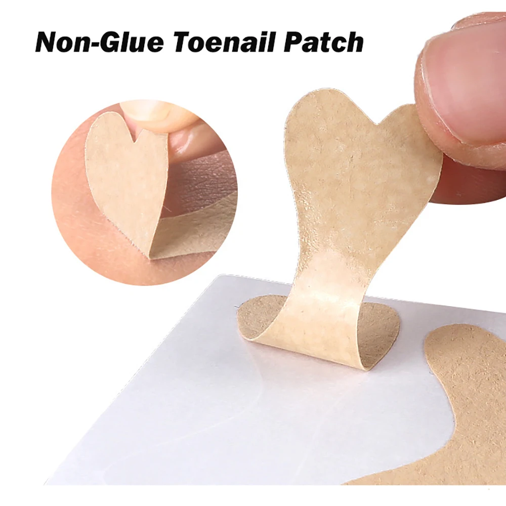 Pexmen 4/20/30/50Pcs Toenail Corrector Patch Nail Patches Ingrown Toenail Corrector Sticker Ingrown Toenail Treatment