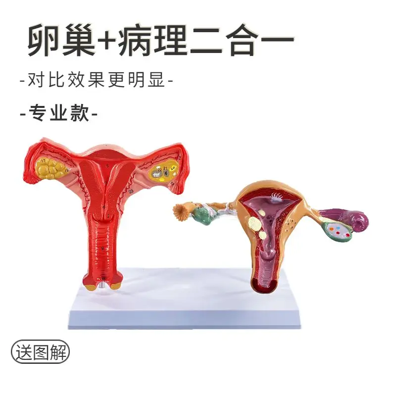 Human Uterine Anatomy Model: Female Vaginal Reproductive System, Bilateral Ovaries, Uterine Normal Pathology, Uterine Teaching