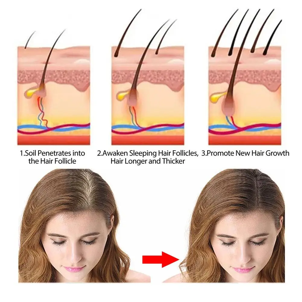 Rosemary Hair Regrowth แชมพูบาร์ทําความสะอาดลึกผมซ่อมแซมผมเสียความงามดูแลเส้นผมสําหรับรักษาผมแห้งเสีย Y6f6