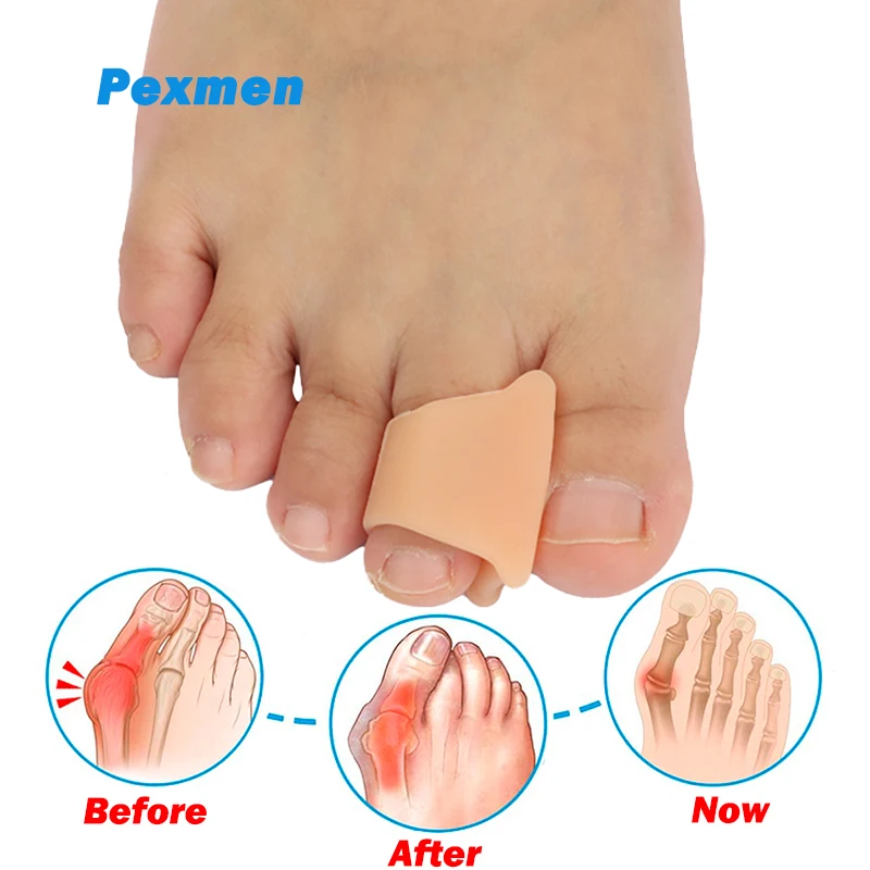 Pexmen 2/4Pcs Hammer Toe Corrector Hammertoe Straightener for Curled Crooked Bent Claw Toes Stop Toe Overlap and Rubbing