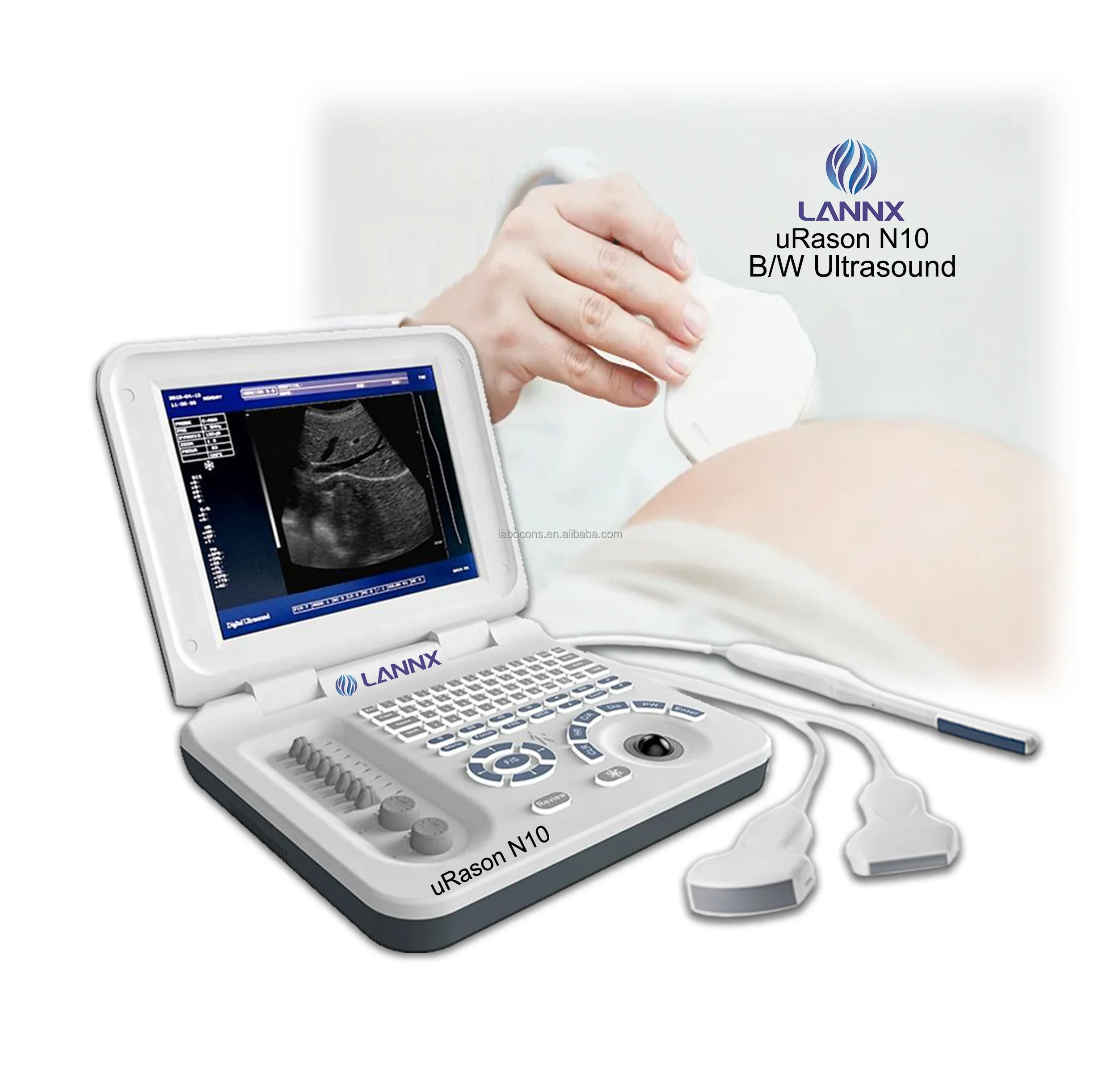 LANNX uRason N10 Well Designed Laptop Ultrasound Machine for Examination B/W Ultrasound Device Scanner