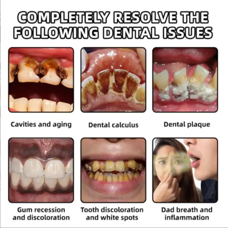 

Отбеливающая зубная паста - глубоко очищает от зубного налета и пятен, осветляет зубы, устраняет неприятный запах изо рта и освежает дыхание.