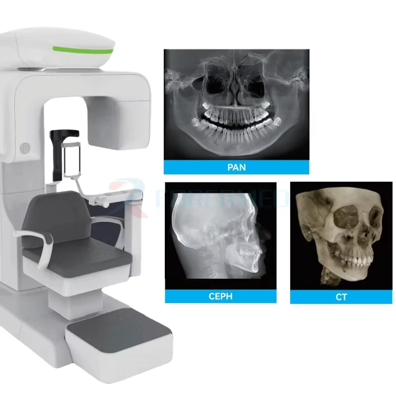 Intelligent 3D CBCT Panoramic Denal X Ray Machine All in One Denta Cephalometric Dentl X Ray Machine