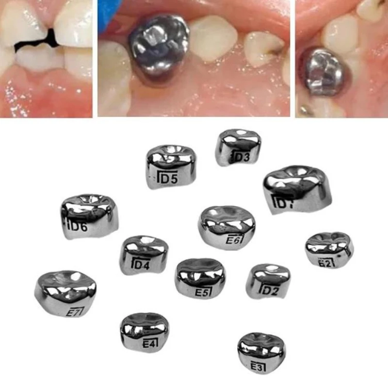 Dental Temporary Crowns Stainless Steel Molar Crown Refill Kit 48 Position For Kids 1st 2nd Preformed Orthodontic Tool