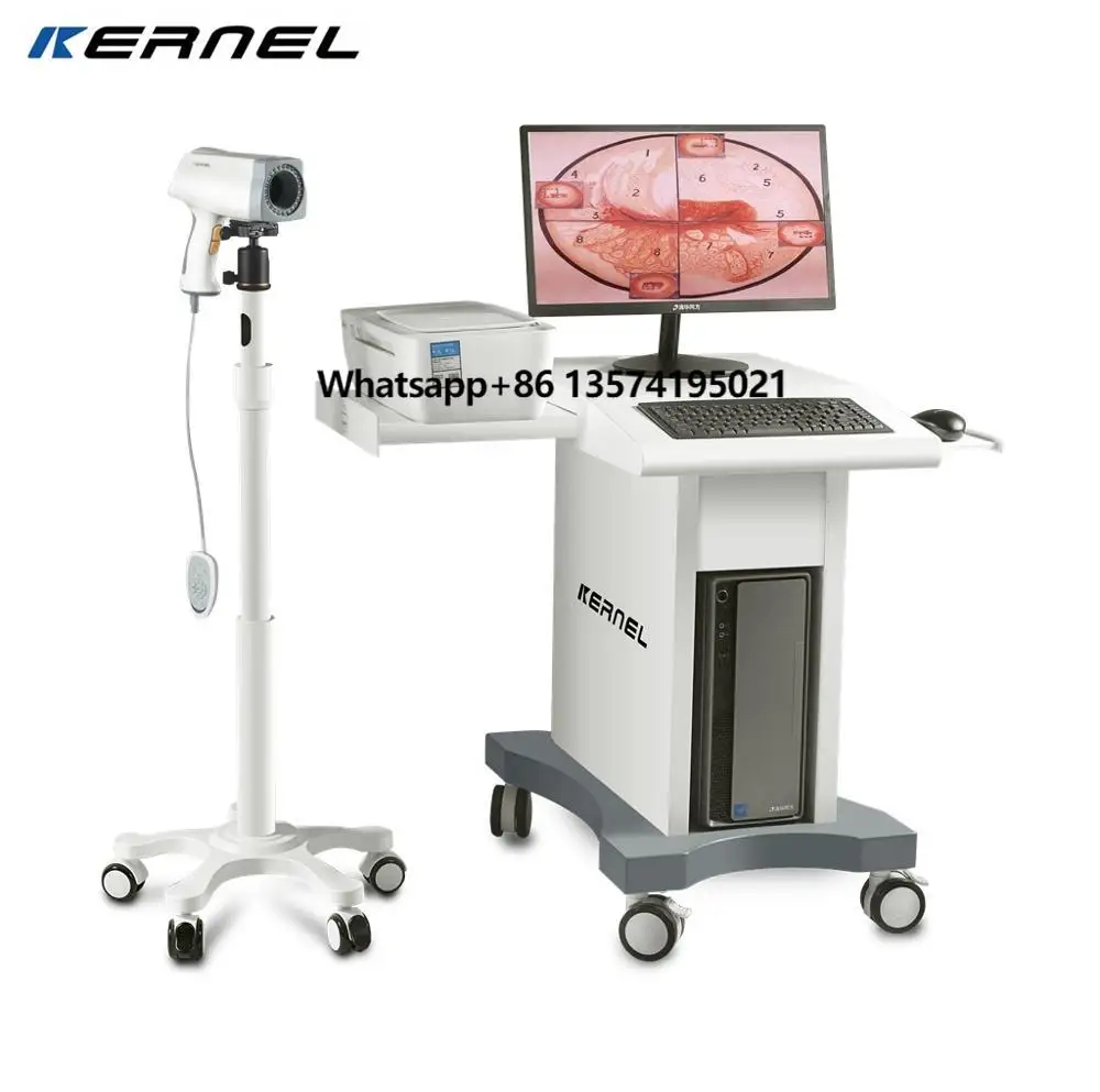 CE Approved KERNEL KN2200 Digital Video for Gynecology Cervix Vagina Examination