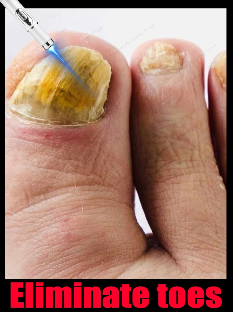 

Nail cleaning tools to restore nail health.