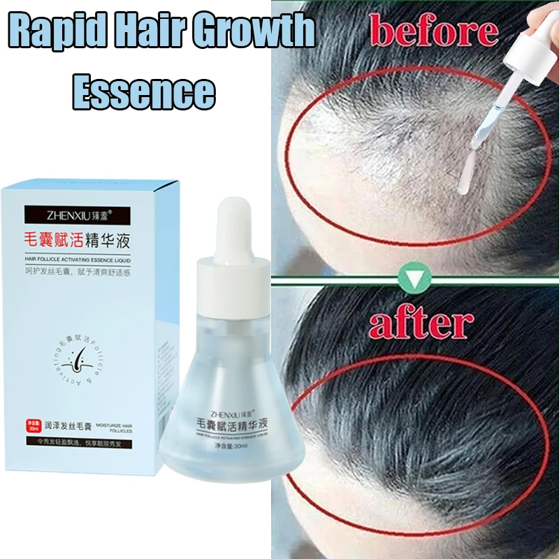 

Эссенция для быстрого роста волос эффективно уменьшает выпадение волос, укрепляет корни волос, глубоко увлажняет, контролирует масло, гладкий блеск, уход за волосами