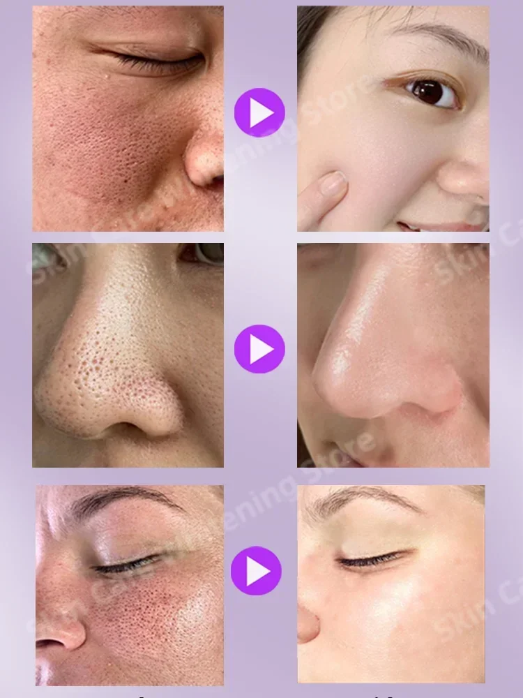 Pore Shrinking Serum Face Pores Remover Serum