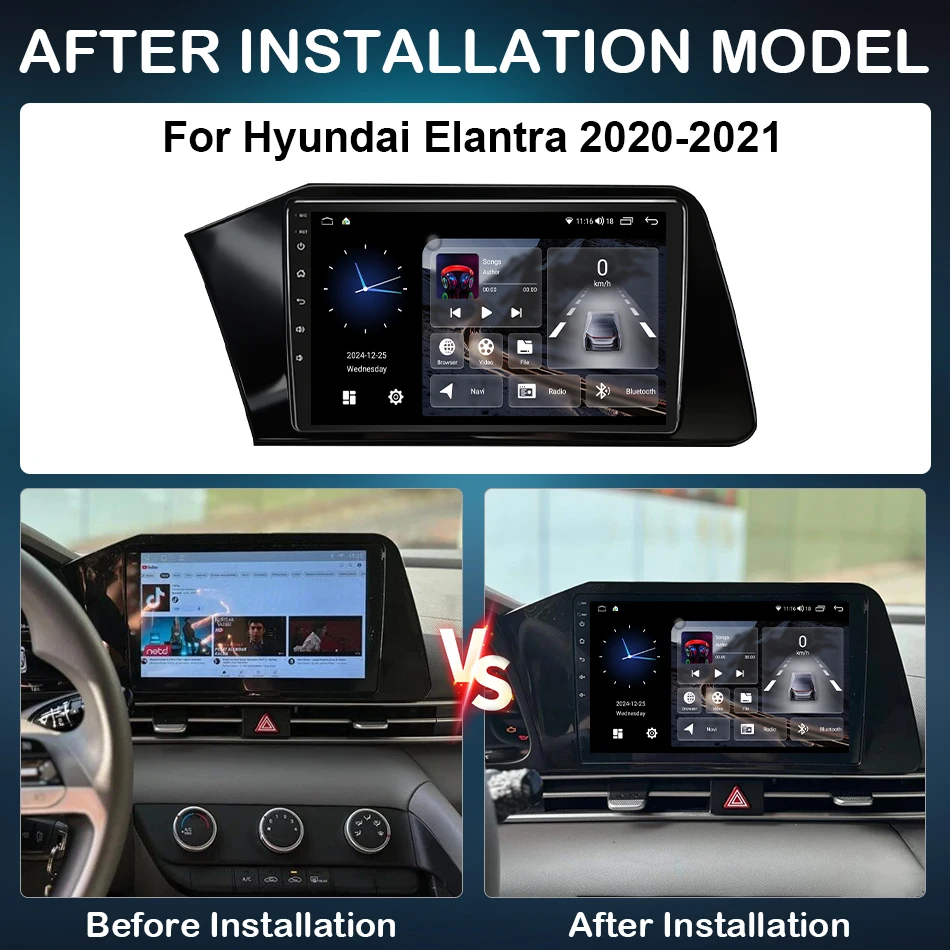 10inch Android 15 For Hyundai Elantra 2020 - 2021 Car Radio Multimedia Stereo Player Auto Accessories Navigation GPS CarPlay DSP