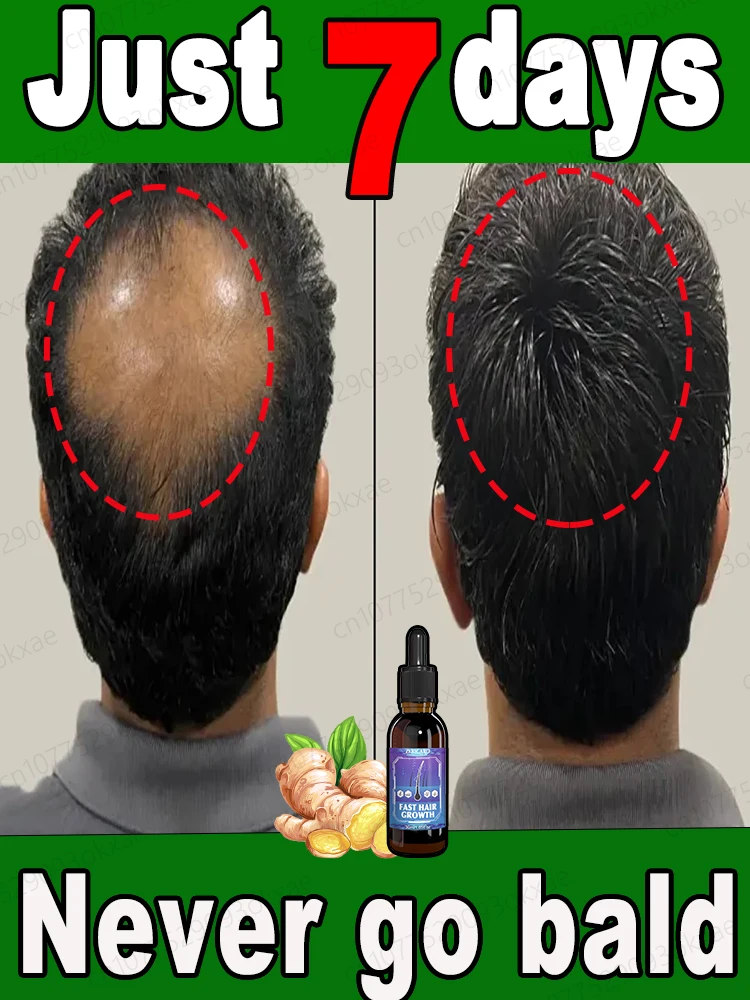 Hair growth essential oil. Effectively repair baldness and hair loss symptoms All natural hair growth products