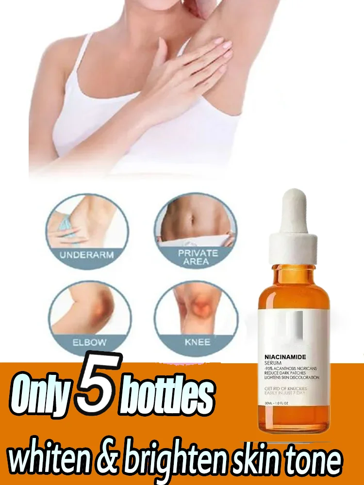 

Dark knuckles whitening serum Elbows Armpit Beaching SerumWoman Private Part Skin Removal Dark Knuckles Strong Whitenin HOT SAL