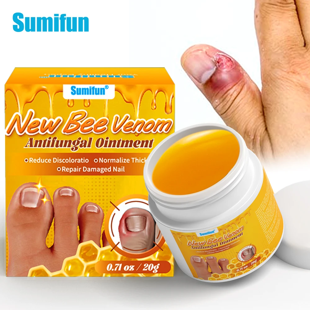 

1/2/3pcs Sumifun Fungal Nail Treatment Cream Fungus Relief Anti-Infection Foot Repair Toe Ointment Paronychia Medical Plaster20g