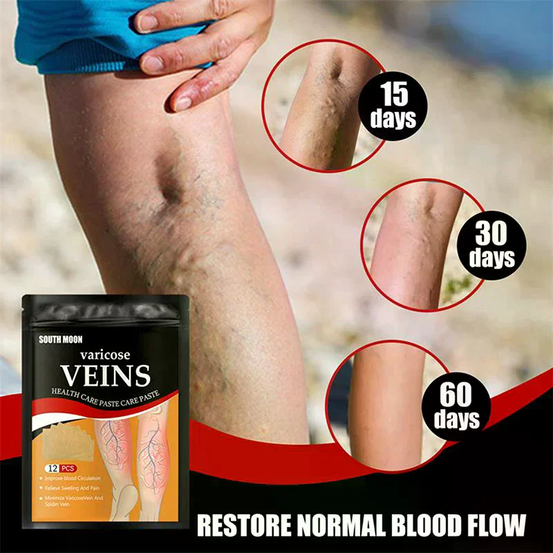 12 Pcs/bag Unisex Varicose Veins Patch Legs Sore Swelling Plaster Promote Metabolism Promote Smooth Blood Circulation