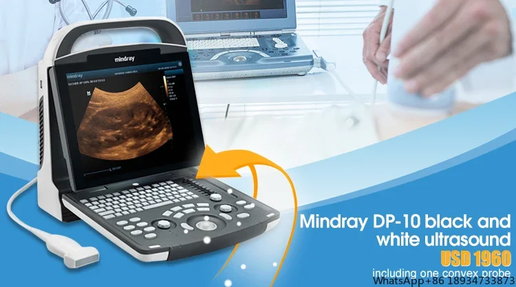 DP10 Mindray Cheapest Smart Portable Ultrasound machine Mindray DP-10 Diagnostic Ultrasound system for hospital