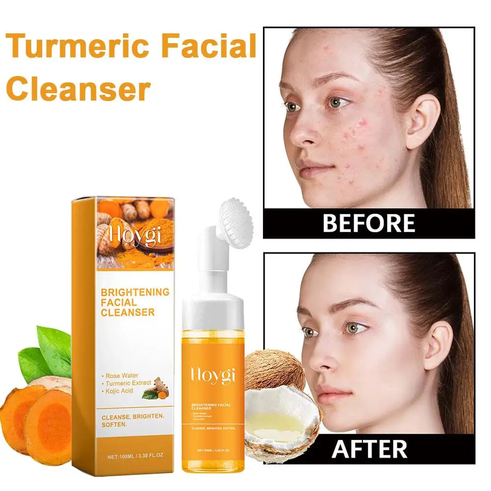 Tuemeric Facial Cleanser for a Radiant Glow Daily Skin Brightening Foaming Face Wash to Even Out Skin Tone, 100ml E5I4