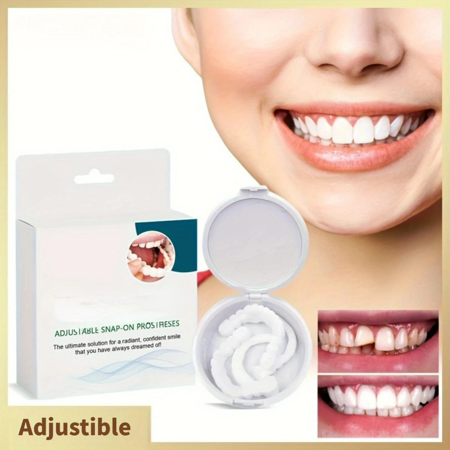 [   Adjustable Complete Orthodontic Denture Kit with Innovative Braces for Tooth Modification and Gap Filling,   Innovative S