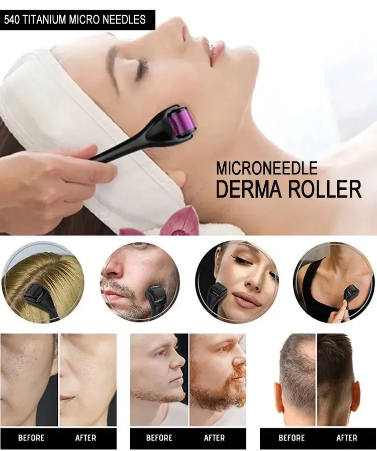 540 Derma Roller Medical Grade Skin Care Microneedling Face Roller Dermaroller for Skin Rejuvenation and Hair Growth