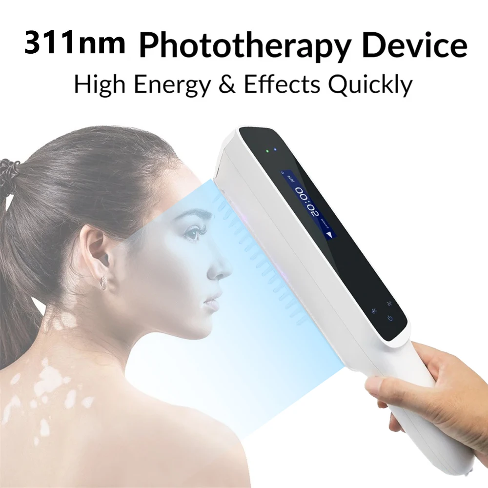 311nm Narrowband Ultraviolet uv Phototherapy Instrument UVB Lamp for Therapy Vitiligo Psoriasis Skin Treatment Light