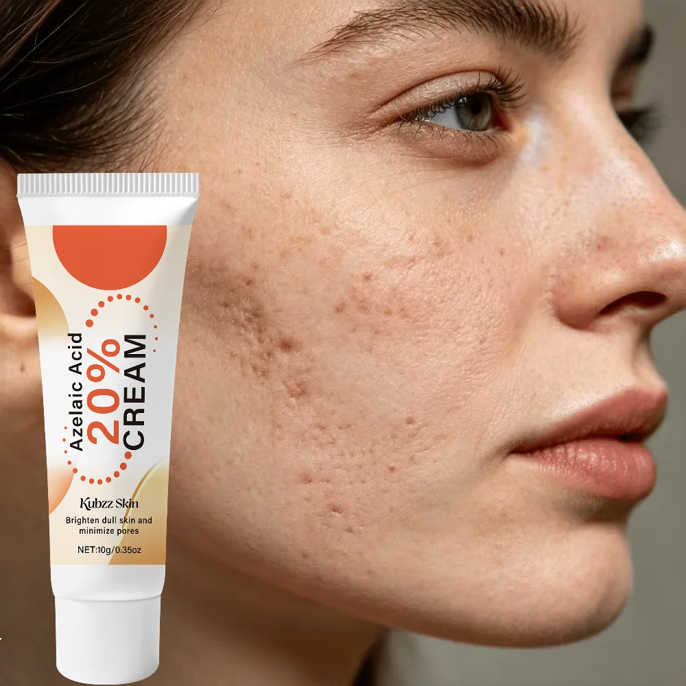 20% Azelaic Acid Cream, Brightening and Pore Care, Soothes and Refines Skin Texture, Suitable for Oily and Sensitive Skin, Facial Moisturizer, Dark Spot Treatment, 10g, Daily Skincare