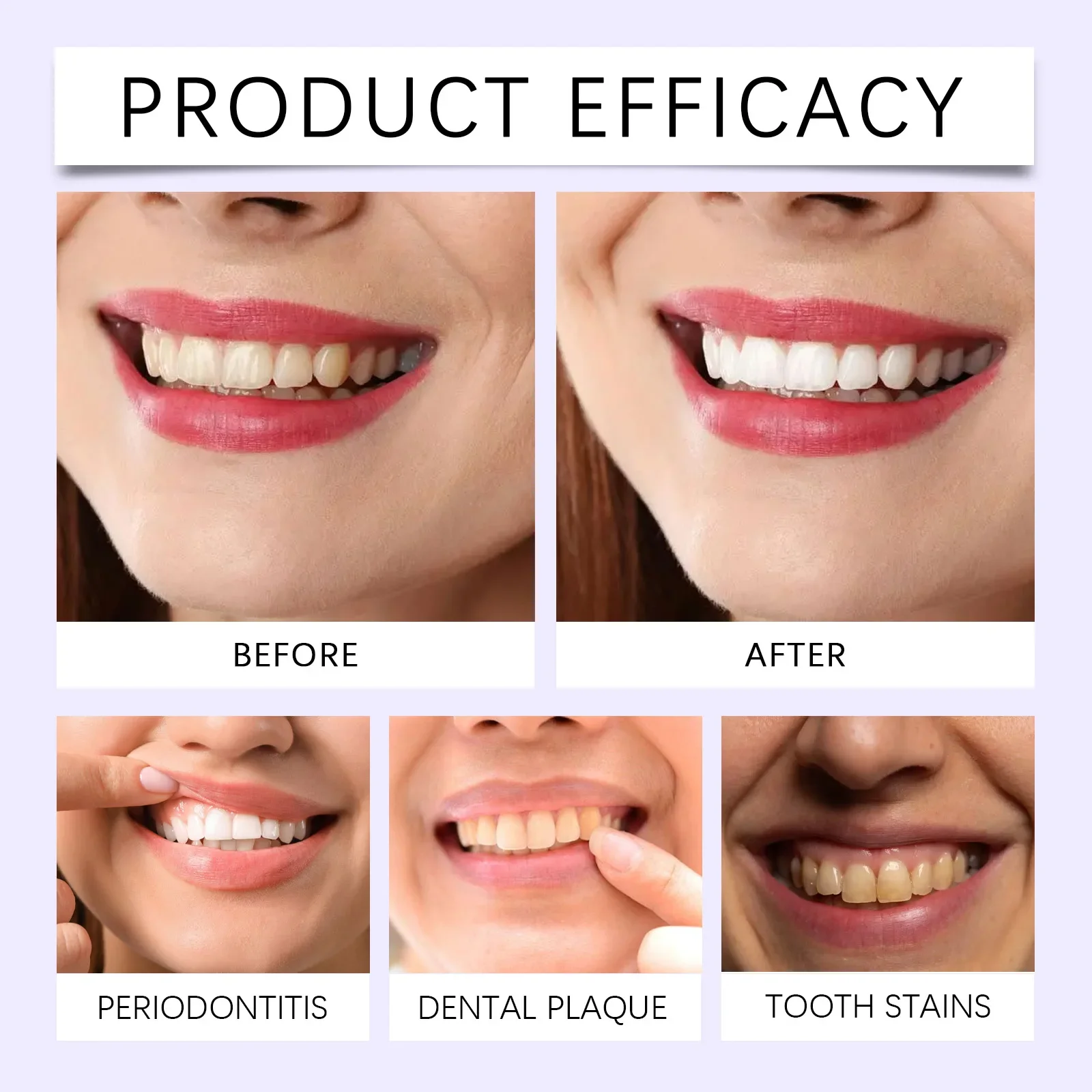 جهاز تنظيف الأسنان المحمول، أدوات تنظيف الأسنان الخفيفة لإصلاح البقع، جهاز تنظيف اللثة للعناية بالفم للاستخدام المنزلي