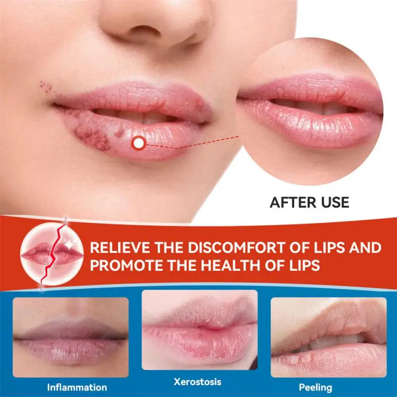 

Remove Dark Lips And Whiten Fade Lip Wrinkles Exfoliated Lip Lipstick Bleaching Dark Lipstick Moisturize And Repair Thin Lips