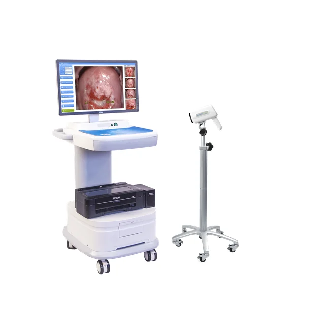 

Portable HD Digital Video Machine Gynecology