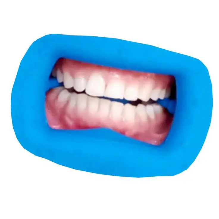 Dental Openers Oral Whitening Teeth Teeth Whitening Tools Soft Silicone Rubber Spacer Can Be Sterilized at High Temperature