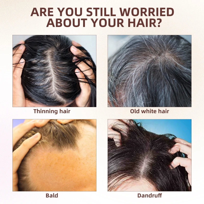 100Ml Sampo Putih Hitam Sampo Polygonum Sangat Bersih Sampo Polygonum Multiflorum Memperbaiki Sampo Rambut Rusak