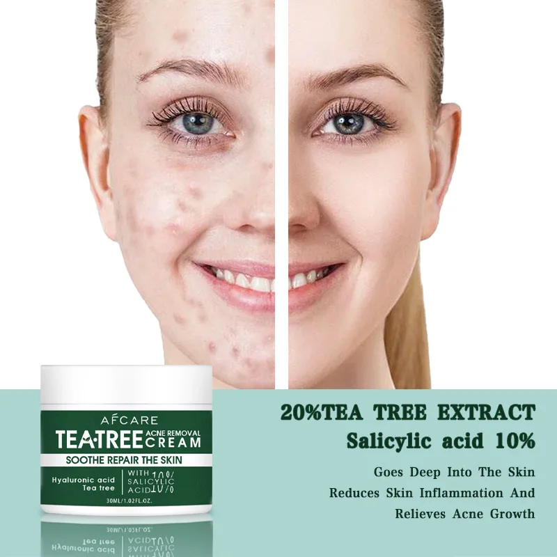 Tea Tree Relief Vegan Facial Cream Non-Sticky Clear Balanced Skin for Soothing Calming Irritated Acne-prone Skin Care Product