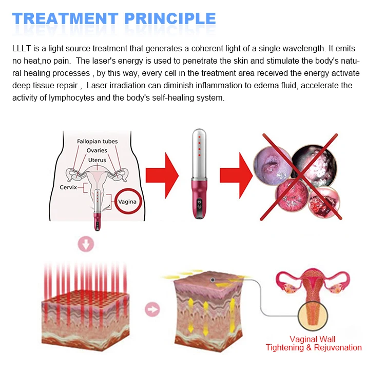 Personal Vaginal Devices for Vagina Tightening Therapy Cold a Rehabilitation Health Care Products