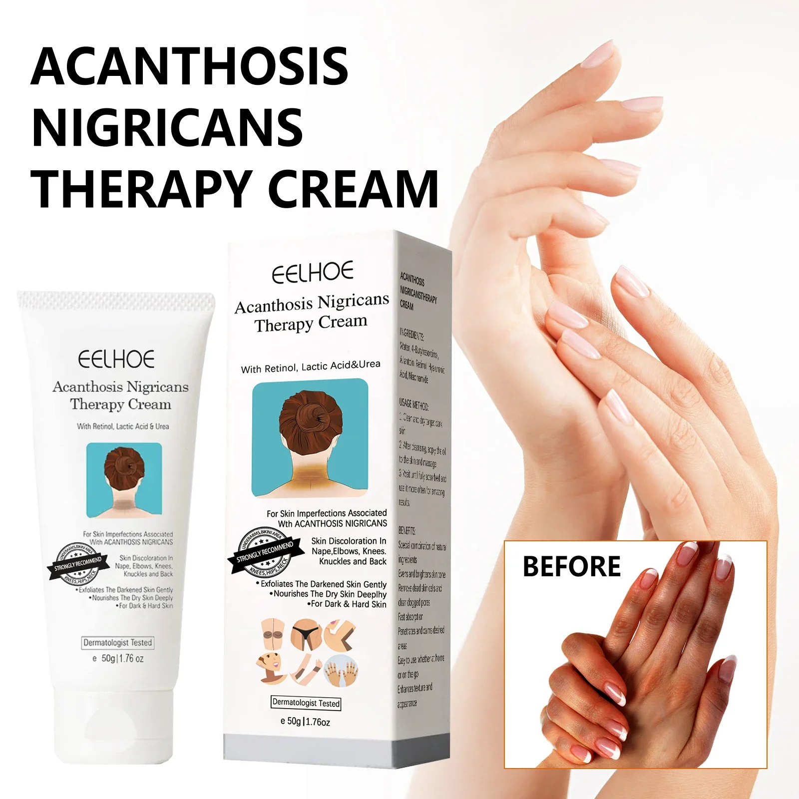 

Black Acanthoderma Moisturizing Repair Cream Brightening Armpits Arms Knees Lightening Emulsion Brighten Skin Body Care Cream