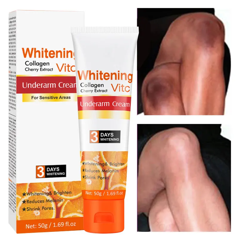 

Effective Fast Whitening Cream Moisturizing Vitamin C Underarm Armpit Legs Knees Private Parts Body Bleaching Smooth Care 50g