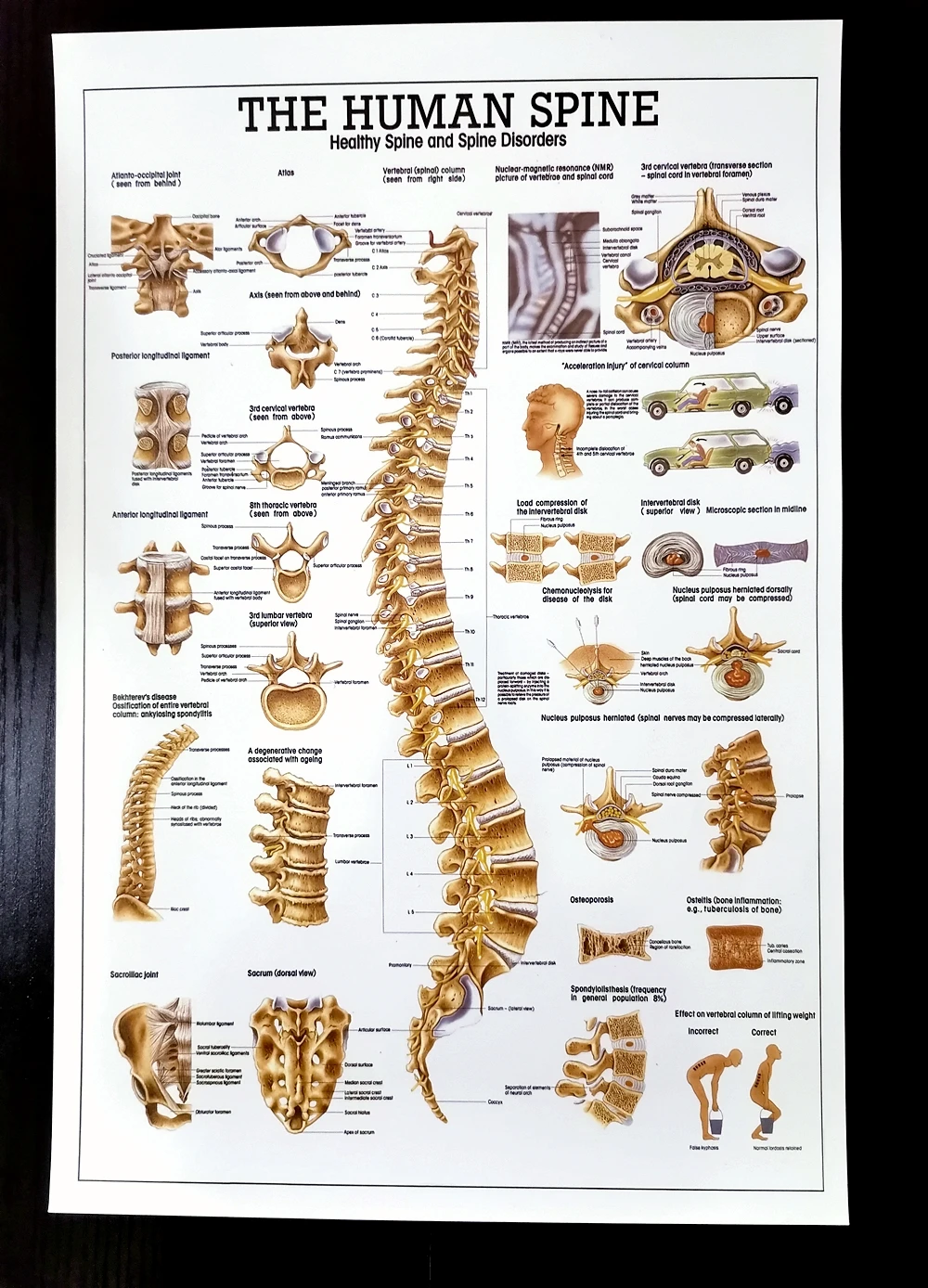 

Водонепроницаемый плакат из ПВХ с человеческим позвоночником, настенный плакат с диаграммой расстройства позвоночника, медицинский плакат с высоким разрешением для украшения дома больничной клиники